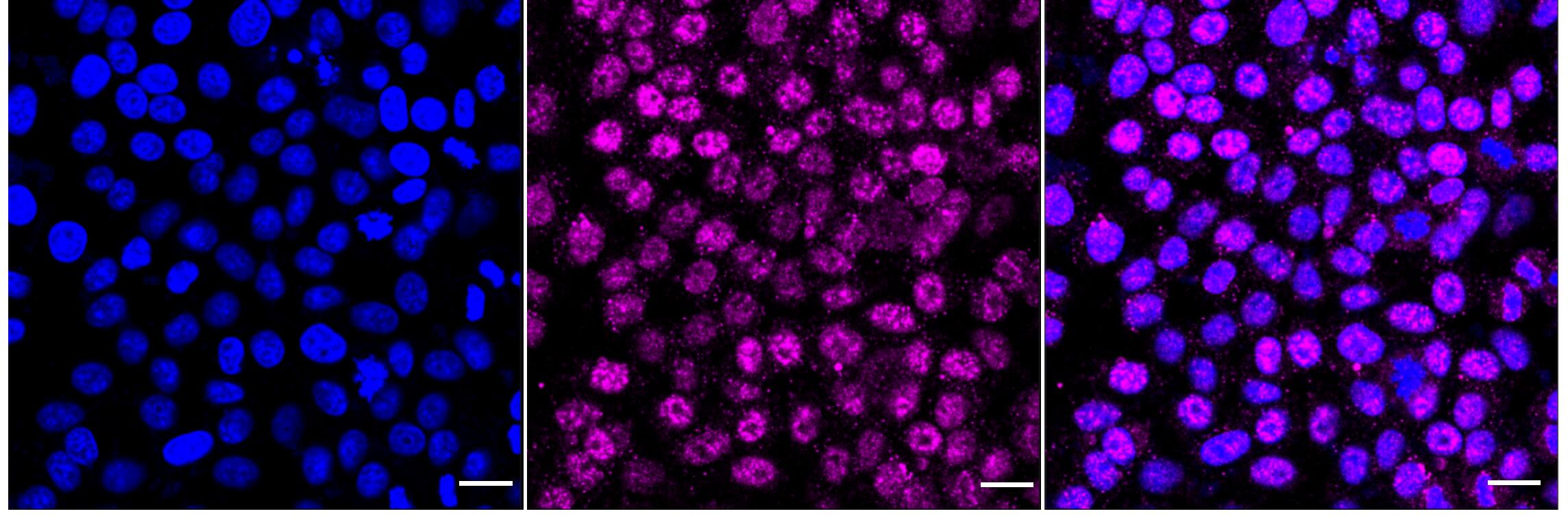 Immunocytochemical staining of HepG2 cells with FosB/G0S3 antibody (1:1,000). Nuclei were stained blue with DAPI; FosB/G0S3 was stained magenta with Alexa Fluor(R) 647. Images were taken using Leica stellaris 5. Protein abundance based on laser Intensity and smart gain: Medium. Scale bar, 20 um.