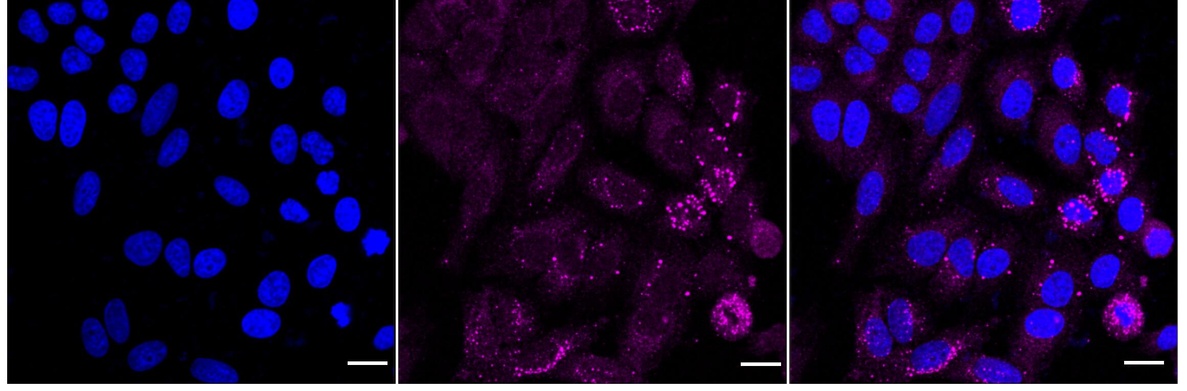 Immunocytochemical staining of HepG2 cells with PP2A alpha/beta antibody (1:1,000). Nuclei were stained blue with DAPI; PP2A alpha/beta was stained magenta with Alexa Fluor(R) 647. Images were taken using Leica stellaris 5. Protein abundance based on laser Intensity and smart gain: Medium. Scale bar, 20 um.
