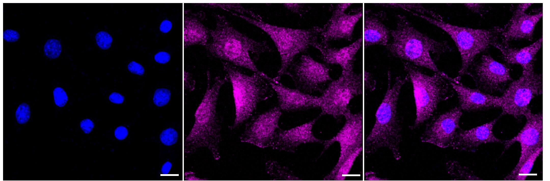 Immunocytochemical staining of C2C12 cells with Caspase-7 antibody (1:1,000). Nuclei were stained blue with DAPI; Caspase-7 was stained magenta with Alexa Fluor(R) 647. Images were taken using Leica stellaris 5. Protein abundance based on laser Intensity and smart gain: Medium. Scale bar, 20 um.