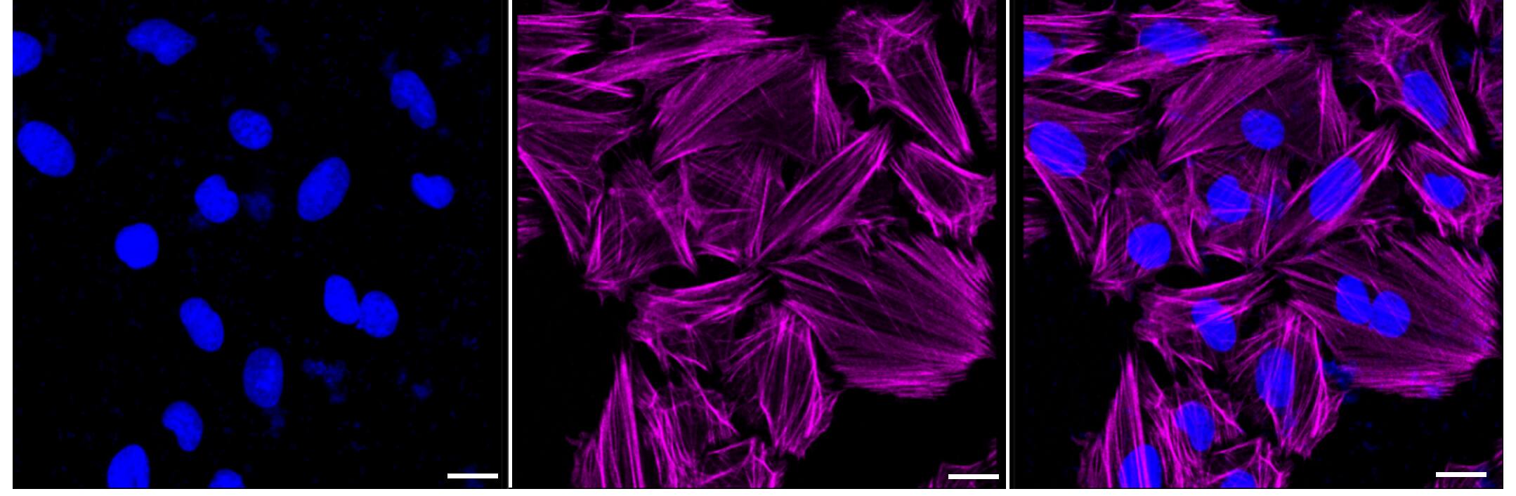 Immunocytochemical staining of H9C2 cells with AMPK beta 1 antibody (1:1,000) . Nuclei were stained blue with DAPI; AMPK beta 1 was stained magenta with Alexa Fluor(R) 647. Images were taken using Leica stellaris 5. Protein abundance based on laser Intensity and smart gain: High. Scale bar, 20 um.