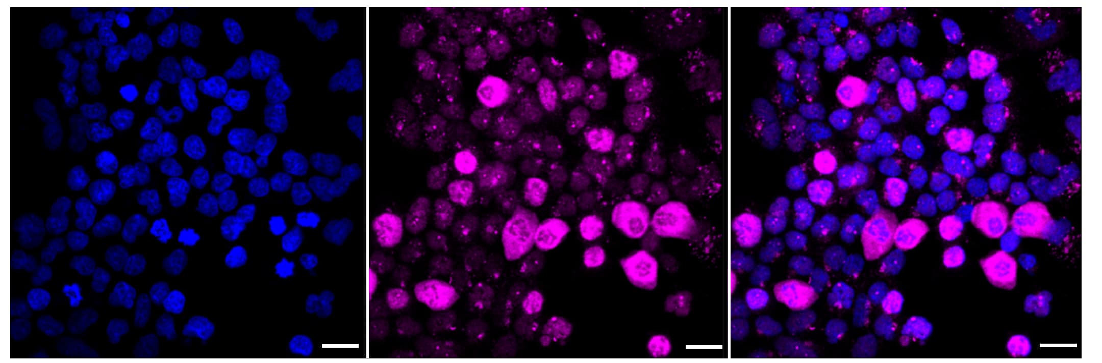 Immunocytochemical staining of HeLa cells with HSF1 antibody (1:1,000). Nuclei were stained blue with DAPI; Phospho-HSF1 (S326) was stained magenta with Alexa Fluor(R) 647. Images were taken using Leica stellaris 5. Protein abundance based on laser Intensity and smart gain: High. Scale bar, 20 um.