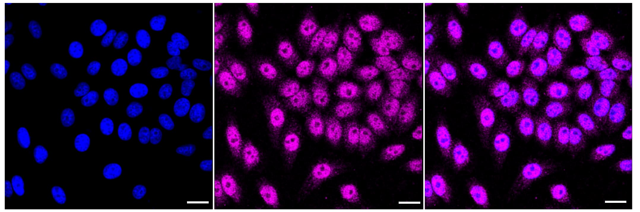 Immunocytochemical staining of HepG2 cells with MCM4 antibody (1:1,000). Nuclei were stained blue with DAPI; MCM4 was stained magenta with Alexa Fluor(R) 647. Images were taken using Leica stellaris 5. Protein abundance based on laser Intensity and smart gain: Medium. Scale bar, 20 um.