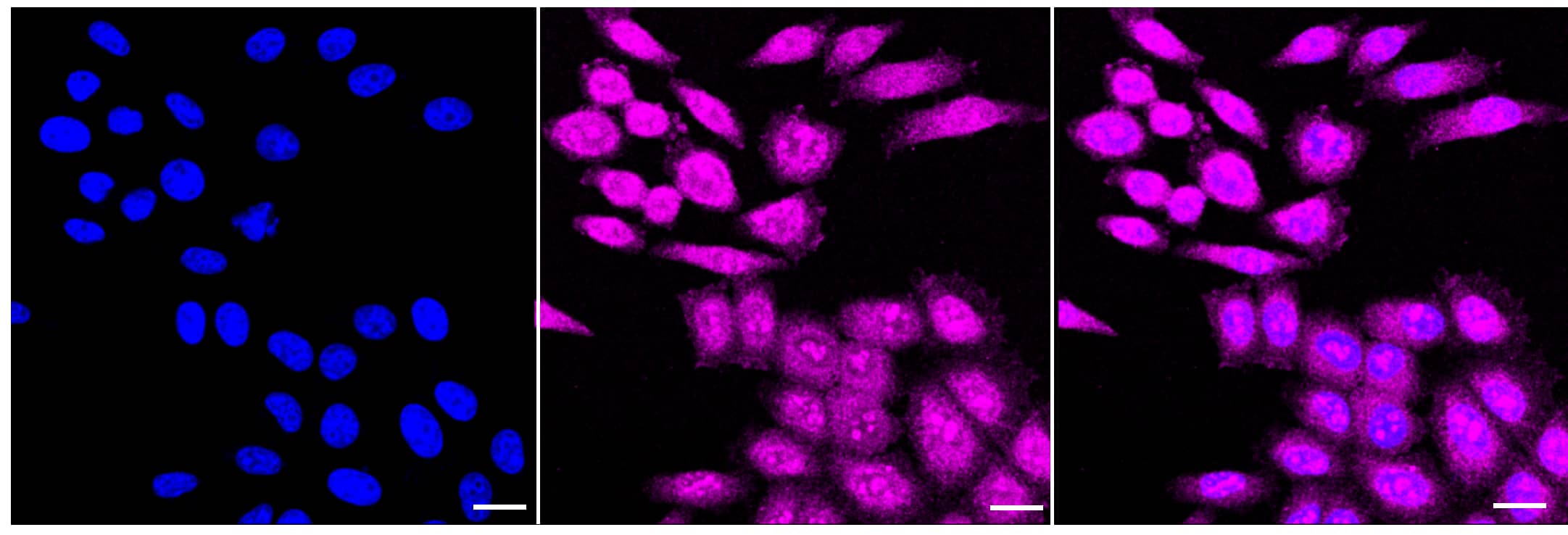 Immunocytochemical staining of HepG2 cells with TBK1 antibody (1:1,000) . Nuclei were stained blue with DAPI; TBK1 was stained magenta with Alexa Fluor(R) 647. Images were taken using Leica stellaris 5. Protein abundance based on laser Intensity and smart gain: Medium. Scale bar, 20 um.