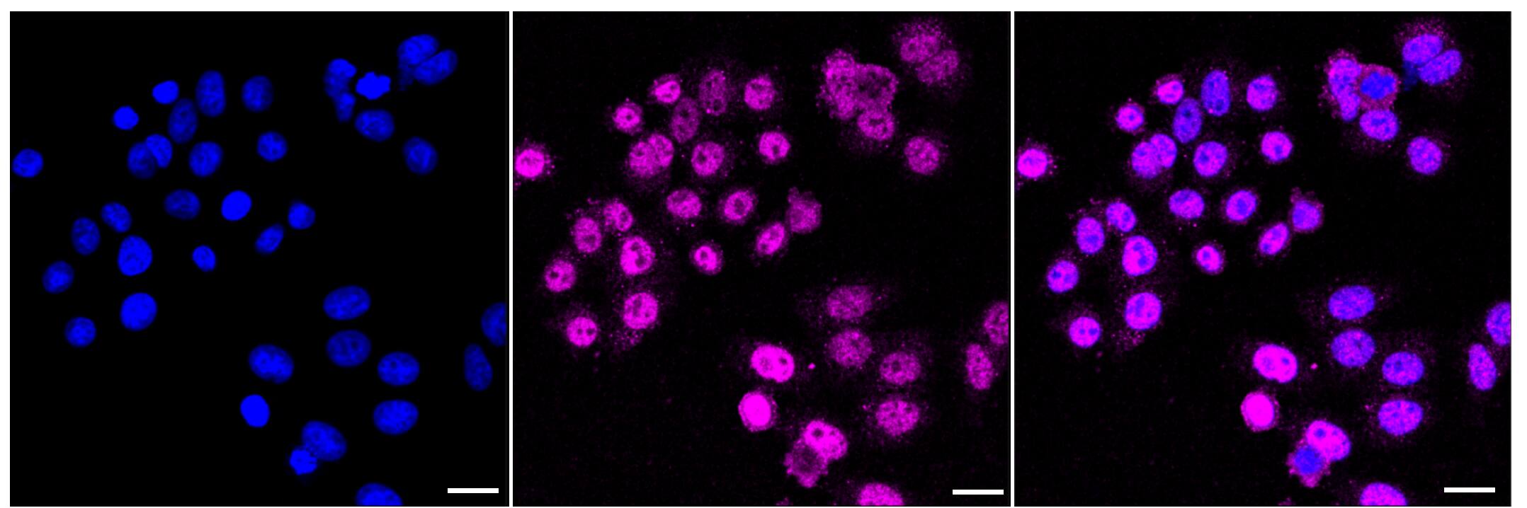 Immunocytochemical staining of HepG2 cells with IKK epsilon/IKBKE antibody (1:1,000). Nuclei were stained blue with DAPI; IKK epsilon/IKBKE was stained magenta with Alexa Fluor(R) 647. Images were taken using Leica stellaris 5. Protein abundance based on laser Intensity and smart gain: Medium. Scale bar, 20 um.