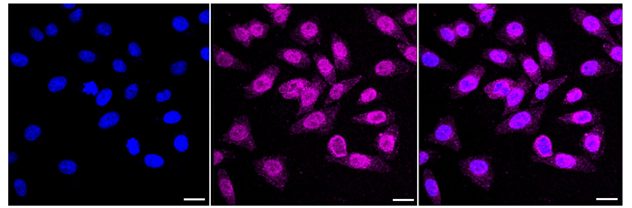 Immunocytochemical staining of HepG2 cells with MEKK3 antibody (1:1,000). Nuclei were stained blue with DAPI; MEKK3 was stained magenta with Alexa Fluor(R) 647. Images were taken using Leica stellaris 5. Protein abundance based on laser Intensity and smart gain: Medium. Scale bar, 20 um.