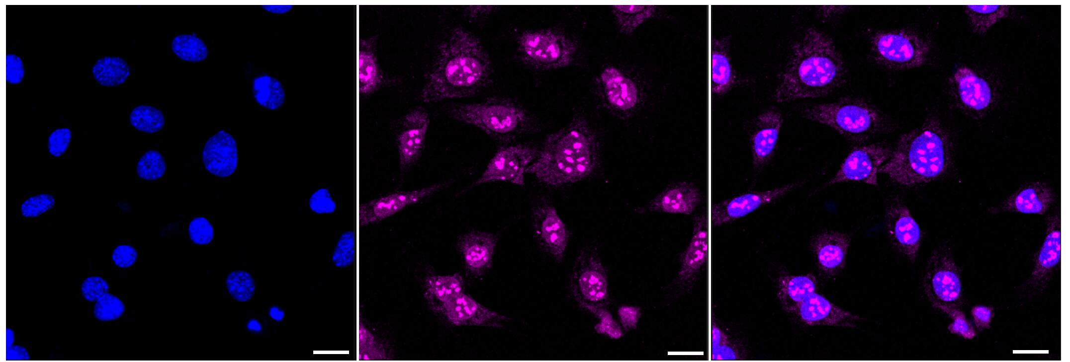 Immunocytochemical staining of C2C12 cells with CENPC antibody (1:1,000). Nuclei were stained blue with DAPI; CENPC was stained magenta with Alexa Fluor(R) 647. Images were taken using Leica stellaris 5. Protein abundance based on laser Intensity and smart gain: Medium. Scale bar, 20 um.