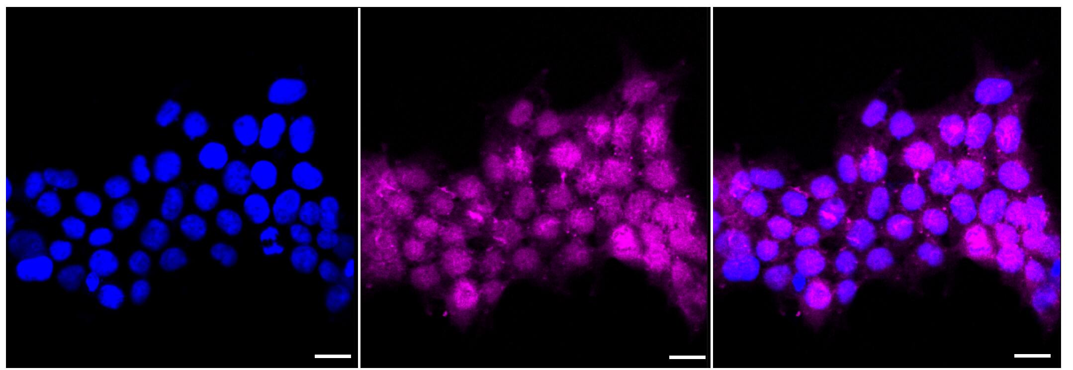 Immunocytochemical staining of Hela cells with ATF5 antibody (1:1,000). Nuclei were stained blue with DAPI; ATF5 was stained magenta with Alexa Fluor(R) 647. Images were taken using Leica stellaris 5. Protein abundance based on laser Intensity and smart gain: Medium. Scale bar, 20 um.
