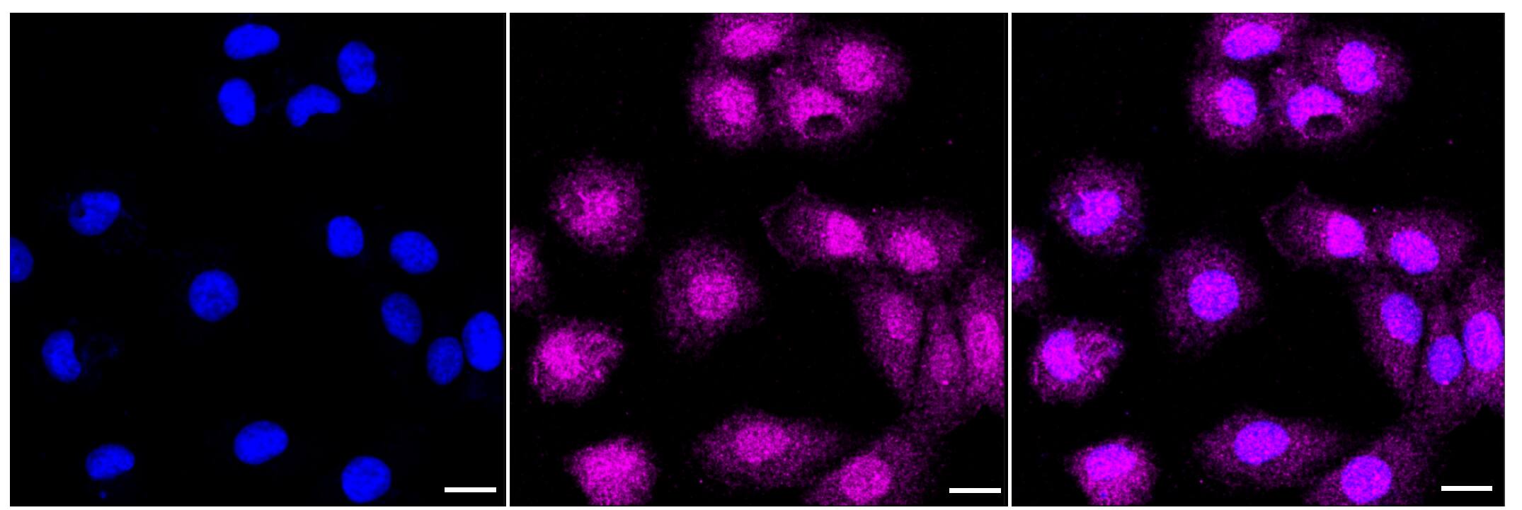 Immunocytochemical staining of HT-1080 cells with UBE2R1/CDC34 antibody (1:1,000). Nuclei were stained blue with DAPI; UBE2R1/CDC34 was stained magenta with Alexa Fluor(R) 647. Images were taken using Leica stellaris 5. Protein abundance based on laser Intensity and smart gain: Medium. Scale bar, 20 um.