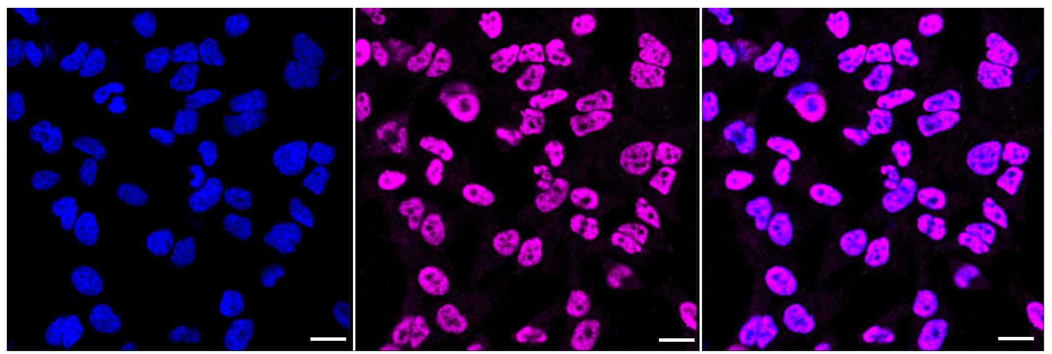 Immunocytochemical staining of Hela cells with XPD antibody (1:1,000). Nuclei were stained blue with DAPI; XPD with Alexa Fluor(R) 647. Images were taken using Leica stellaris 5. Protein abundance based on laser Intensity and smart gain: Medium. Scale bar, 20 um.