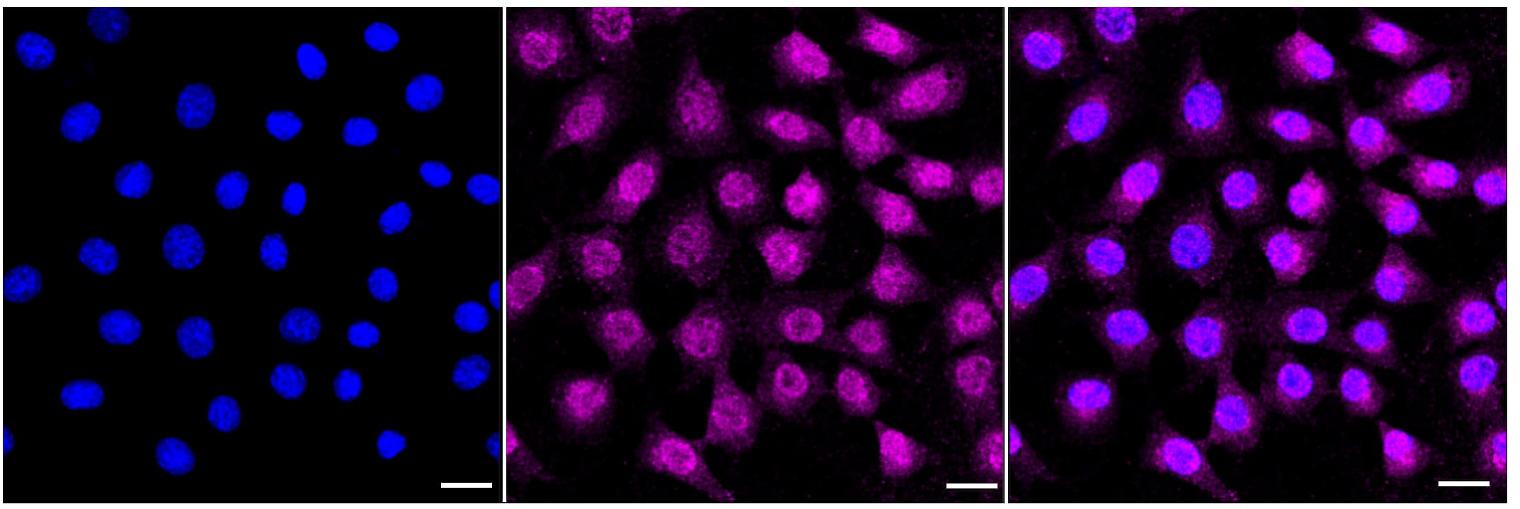 Immunocytochemical staining of C2C12 cells with Biglycan antibody (1:1,000). Nuclei were stained blue with DAPI; Biglycan was stained magenta with Alexa Fluor(R) 647. Images were taken using Leica stellaris 5. Protein abundance based on laser Intensity and smart gain: Medium. Scale bar, 20 um.