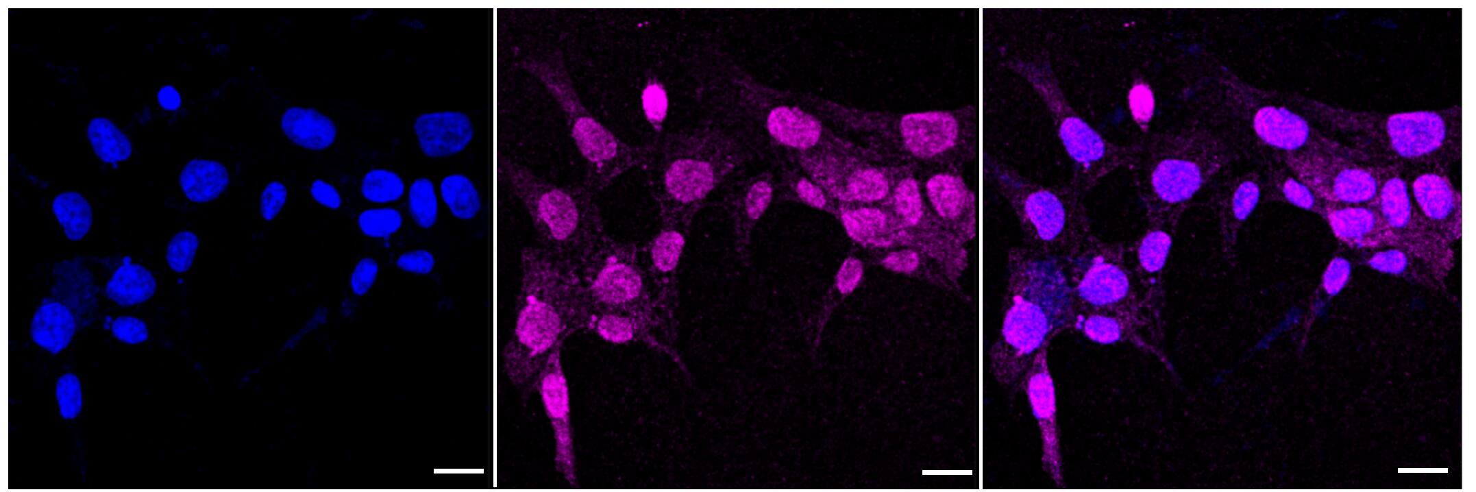 Immunocytochemical staining of HAP-1 cells with Creatine Kinase B (1:1,000). Nuclei were stained blue with DAPI; Creatine kinase B was stained magenta with Alexa Fluor(R) 647. Images were taken using Leica stellaris 5. Protein abundance based on laser Intensity and smart gain: Medium. Scale bar, 20 um.
