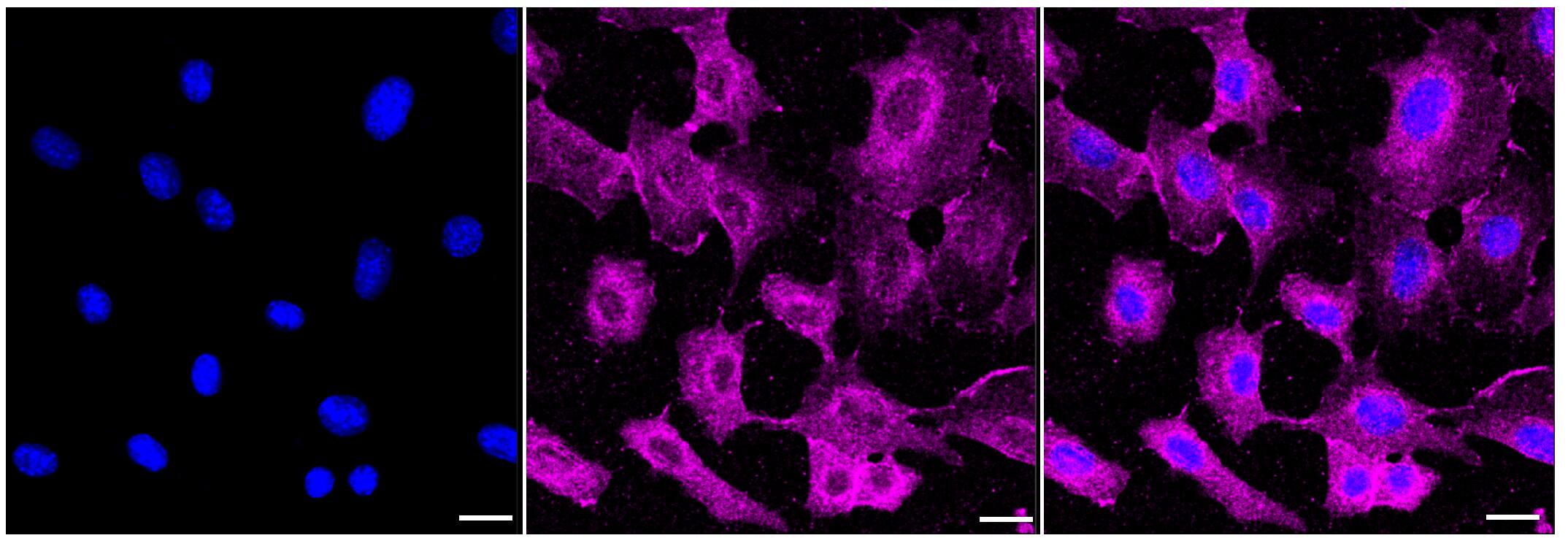 Immunocytochemical staining of C2C12 cells with p120-catenin antibody (1:1,000). Nuclei were stained blue with DAPI; p120-catenin was stained magenta with Alexa Fluor(R) 647. Images were taken using Leica stellaris 5. Protein abundance based on laser Intensity and smart gain: Medium. Scale bar, 20 um.