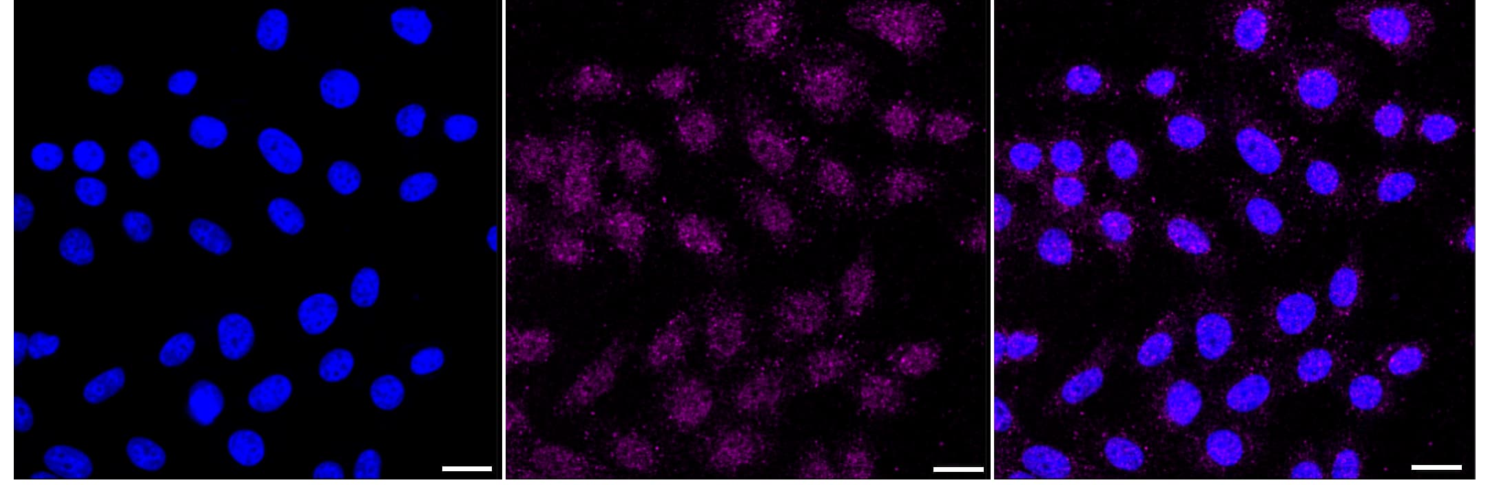 Immunocytochemical staining of HepG2 cells with EGFR antibody (1:1,000). Nuclei were stained blue with DAPI; EGFR was stained magenta with Alexa Fluor(R) 647. Images were taken using Leica stellaris 5. Protein abundance based on laser Intensity and smart gain: Low. Scale bar, 20 um.