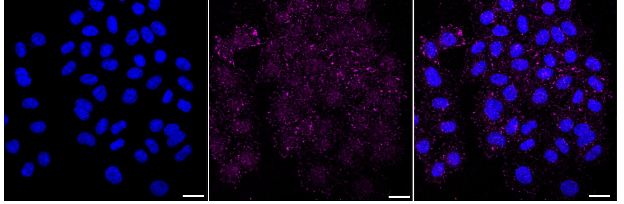 Immunocytochemical staining of HepG2 cells with EGFR antibody (1:1,000). Nuclei were stained blue with DAPI; EGFR was stained magenta with Alexa Fluor(R) 647. Images were taken using Leica stellaris 5. Protein abundance based on laser Intensity and smart gain: Low. Scale bar, 20 um.