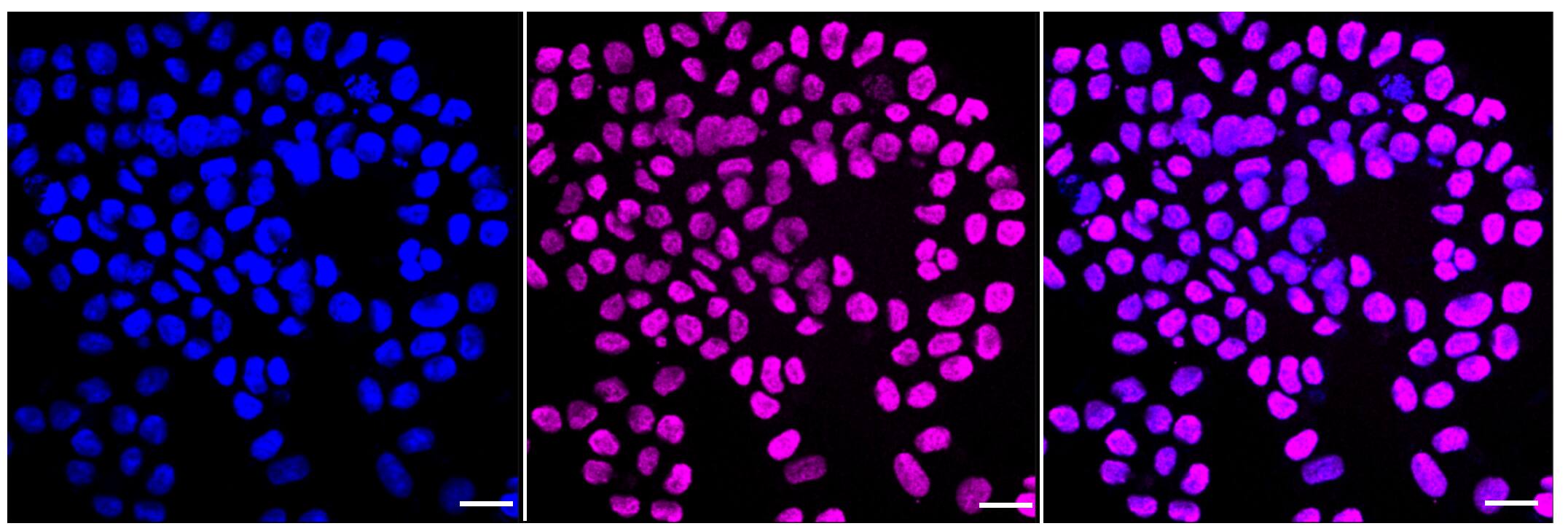 Immunocytochemical staining of HAP-1 cells with Histone H3 antibody (1:1,000). Nuclei were stained blue with DAPI; Histone H3 was stained magenta with Alexa Fluor(R) 647. Images were taken using Leica stellaris 5. Protein abundance based on laser Intensity and smart gain: High. Scale bar, 20 um.