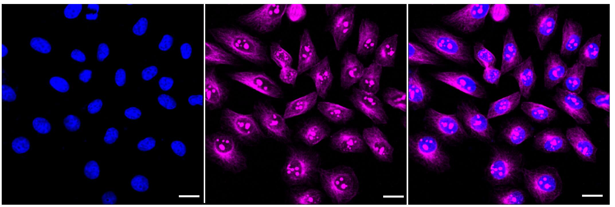 Immunocytochemical staining of HepG2 cells with STAT3 antibody (1:1,000). Nuclei were stained blue with DAPI; STAT3 was stained magenta with Alexa Fluor(R) 647. Images were taken using Leica stellaris 5. Protein abundance based on laser Intensity and smart gain: High. Scale bar, 20 um.