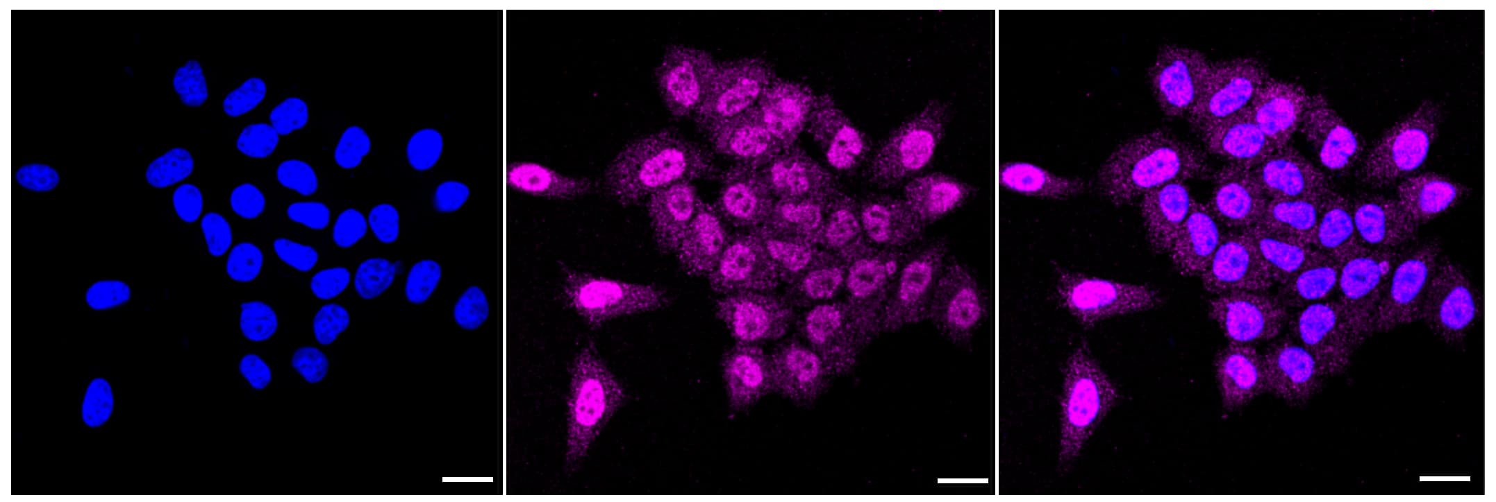 Immunocytochemical staining of HepG2 cells with Tensin 4/CTEN (1:1,000). Nuclei were stained blue with DAPI; Tensin  was stained magenta with Alexa Fluor(R) 647. Images were taken using Leica stellaris 5. Protein abundance based on laser Intensity and smart gain: Medium. Scale bar, 20 um.