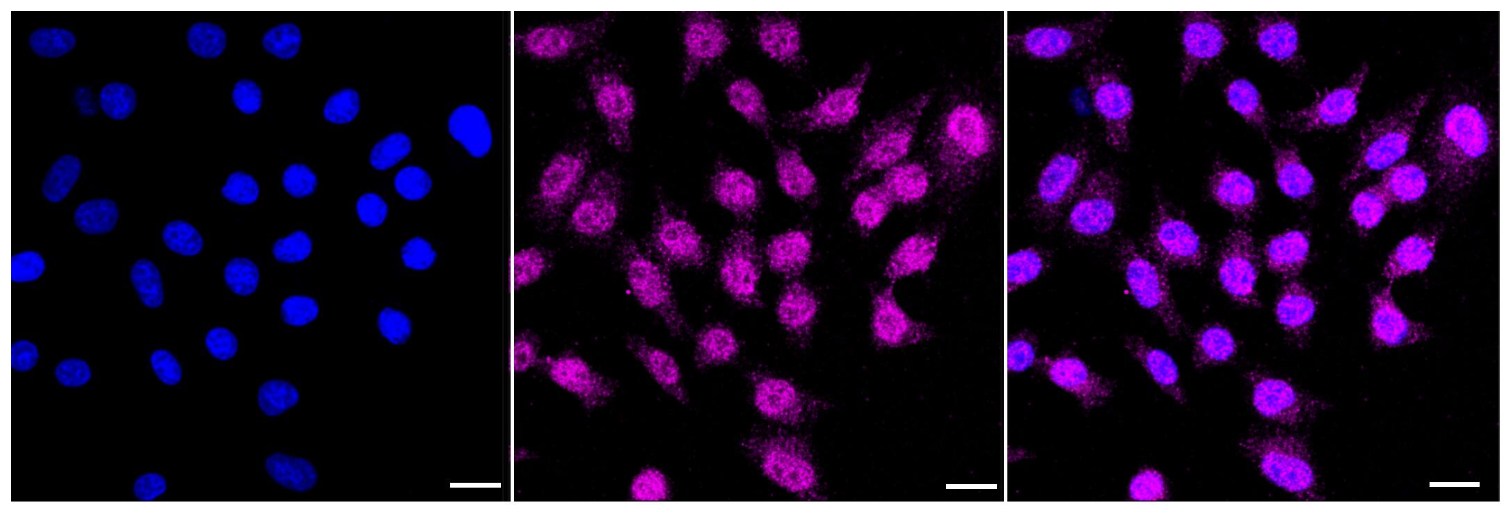Immunocytochemical staining of HepG2 cells with Xanthine Oxidase antibody (1:1,000). Nuclei were stained blue with DAPI; Xanthine Oxidase was stained magenta with Alexa Fluor(R) 647. Images were taken using Leica stellaris 5. Protein abundance based on laser Intensity and smart gain: Medium. Scale bar, 20 um.