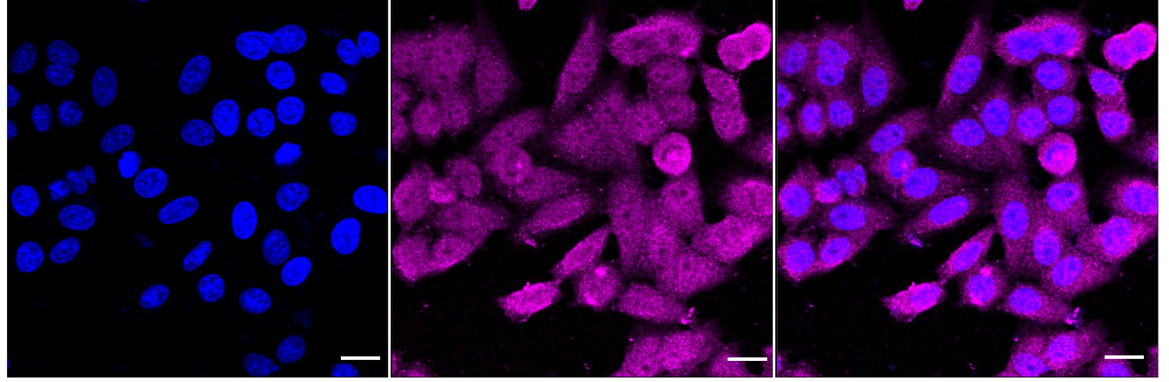 Immunocytochemical staining of HepG2 cells with ALDH16A1 antibody (1:1,000). Nuclei were stained blue with DAPI; ALDH16A1 was stained magenta with Alexa Fluor(R) 647. Images were taken using Leica stellaris 5. Protein abundance based on laser Intensity and smart gain: Medium. Scale bar, 20 um.