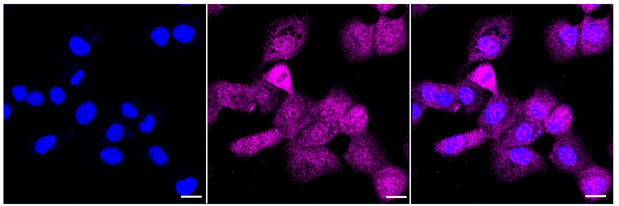 Immunocytochemistry/ Immunofluorescence CABP1 Antibody (23GB4365)