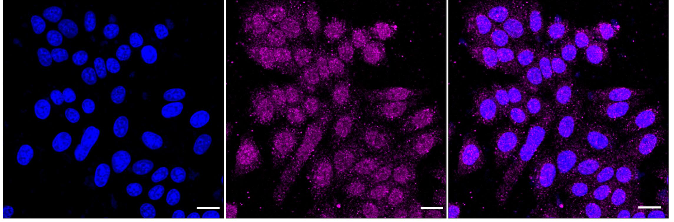Immunocytochemical staining of HepG2 cells with Histone H3 antibody (1:1,000). Nuclei were stained blue with DAPI; Histone H3 (mono methyl K79) was stained magenta with Alexa Fluor(R) 647. Images were taken using Leica stellaris 5. Protein abundance based on laser Intensity and smart gain: Medium. Scale bar: 20 um.