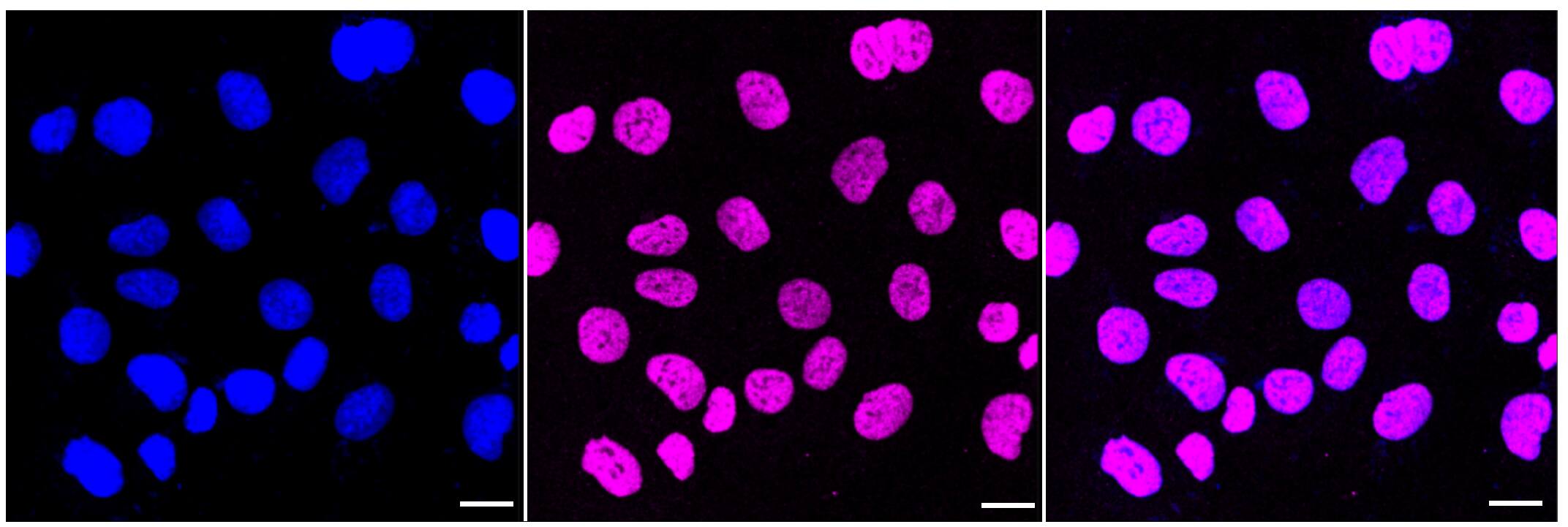 Immunocytochemical staining of HT-1080 cells with Histone H3 antibody (1:1,000). Nuclei were stained blue with DAPI; Histone H3 was stained magenta with Alexa Fluor(R) 647. Images were taken using Leica stellaris 5. Protein abundance based on laser Intensity and smart gain: Medium. Scale bar, 20 um.