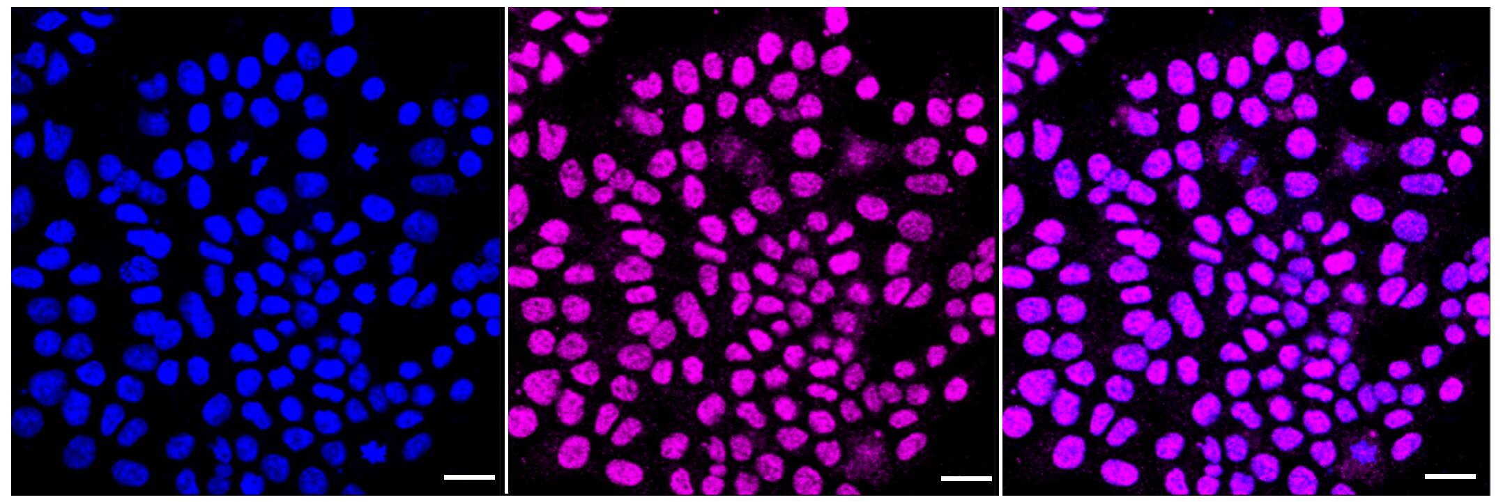 Immunocytochemical staining of HAP-1 cells with PP2A alpha (1:1,000). Nuclei were stained blue with DAPI; Phospho-PP2A alpha (Y307)  was stained magenta with Alexa Fluor(R) 647. Images were taken using Leica stellaris 5. Protein abundance based on laser Intensity and smart gain: Low. Scale bar, 20 um.