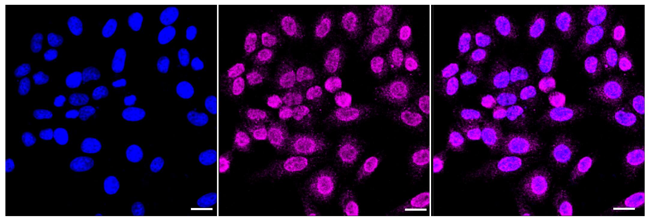 Immunocytochemical staining of HepG2 cells with RASSF2 antibody (1:1,000). Nuclei were stained blue with DAPI; RASSF2 was stained magenta with Alexa Fluor(R) 647. Images were taken using Leica stellaris 5. Protein abundance based on laser Intensity and smart gain: Low. Scale bar, 20 um.