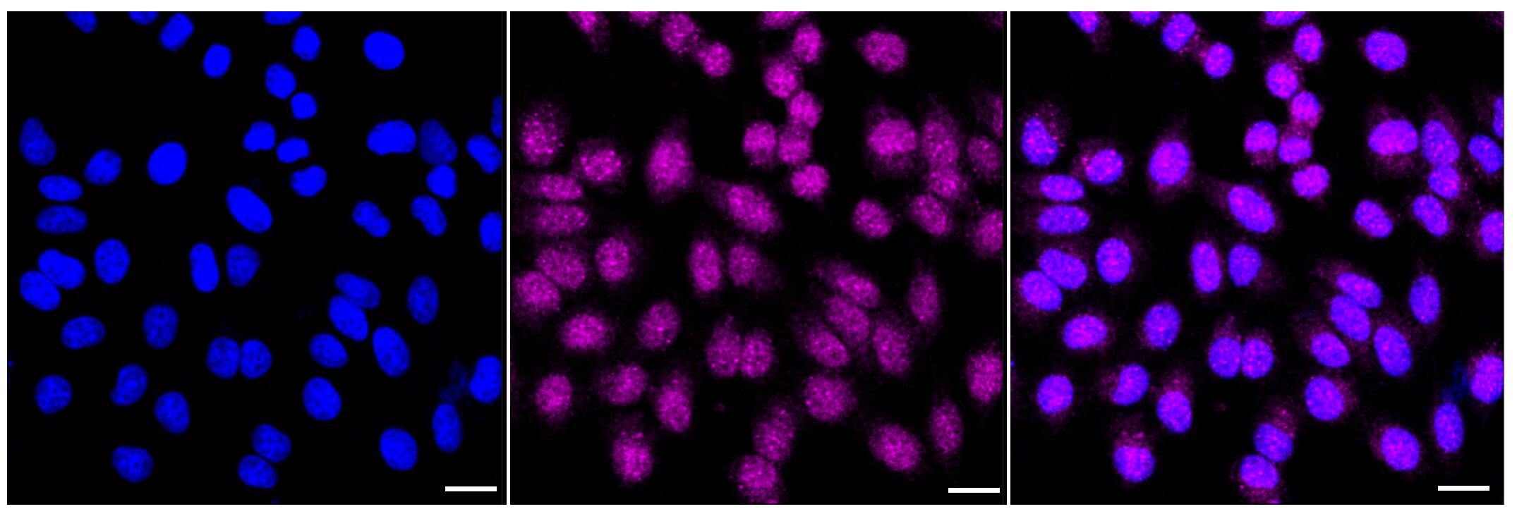 Immunocytochemical staining of HepG2 cells with TEAD1/2/3/4 antibody (1:1,000). Nuclei were stained blue with DAPI; TEAD1/2/3/4 was stained magenta with Alexa Fluor(R) 647. Images were taken using Leica stellaris 5. Protein abundance based on laser Intensity and smart gain: Medium. Scale bar, 20 um.