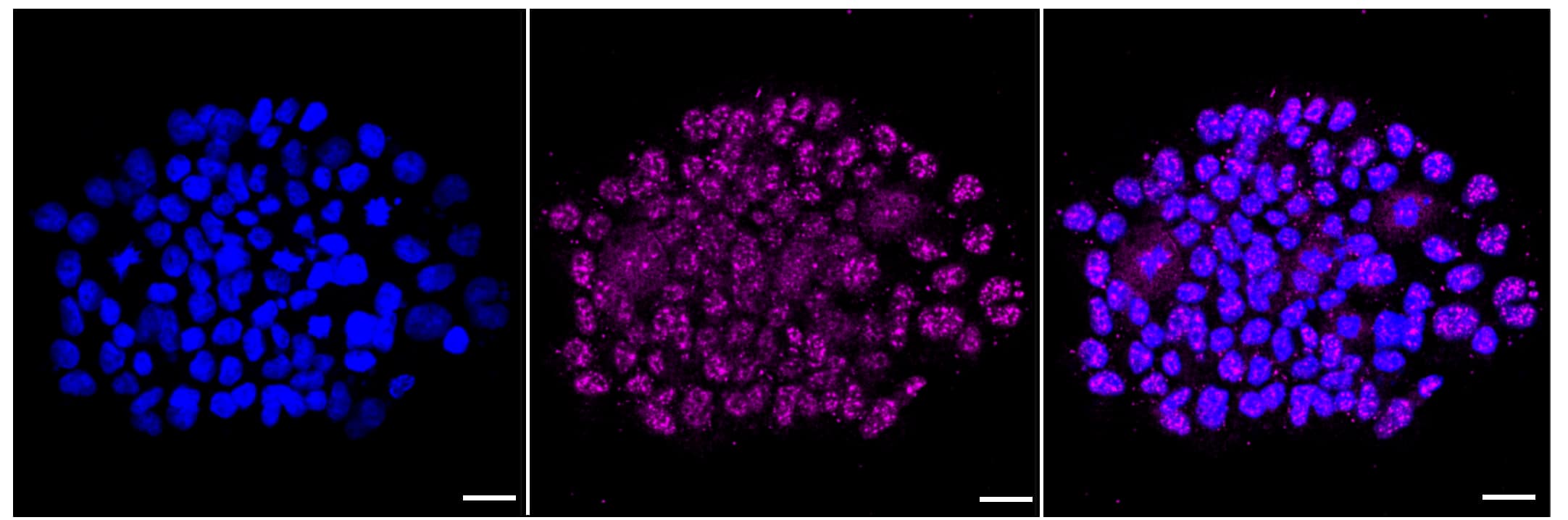 Immunocytochemical staining of HAP-1 cells with AMPK alpha 2 (1:1,000). Nuclei were stained blue with DAPI; Phospho-AMPK alpha 2 (S491) was stained magenta with Alexa Fluor(R) 647. Images were taken using Leica stellaris 5. Protein abundance based on laser Intensity and smart gain: Low. Scale bar, 20 um.
