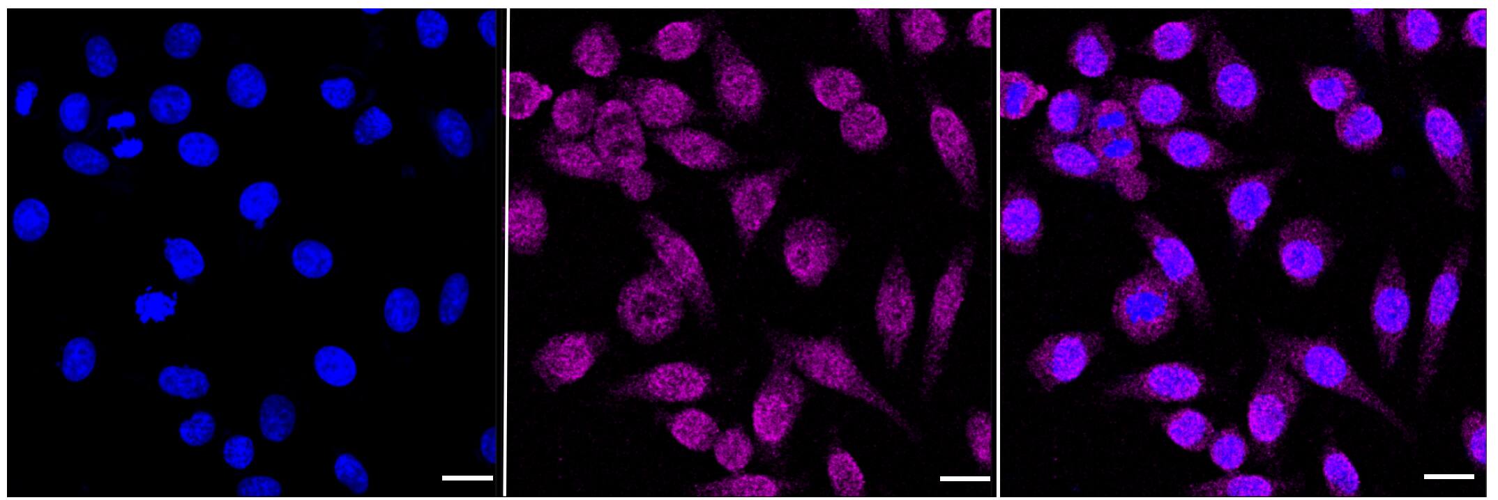 Immunocytochemical staining of HepG2 cells with 14-3-3 zeta/beta antibody (1:1,000). Nuclei were stained blue with DAPI; 14-3-3 was stained magenta with Alexa Fluor(R) 647. Images were taken using Leica stellaris 5. Protein abundance based on laser Intensity and smart gain: Low. Scale bar, 20 um.