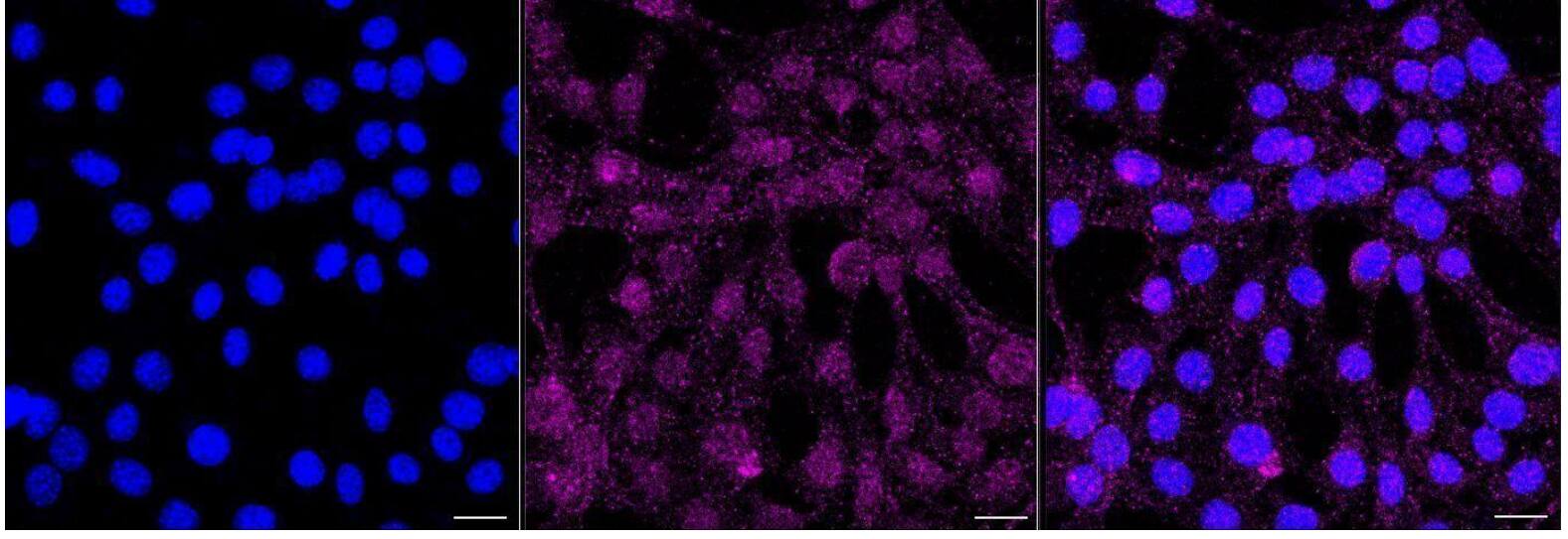 Immunocytochemical staining of C2C12 cells with BTK antibody (1:1,000). Nuclei were stained blue with DAPI; BTK was stained magenta with Alexa Fluor(R) 647. Images were taken using Leica stellaris 5. Protein abundance based on laser Intensity and smart gain: Medium. Scale bar, 20 um.