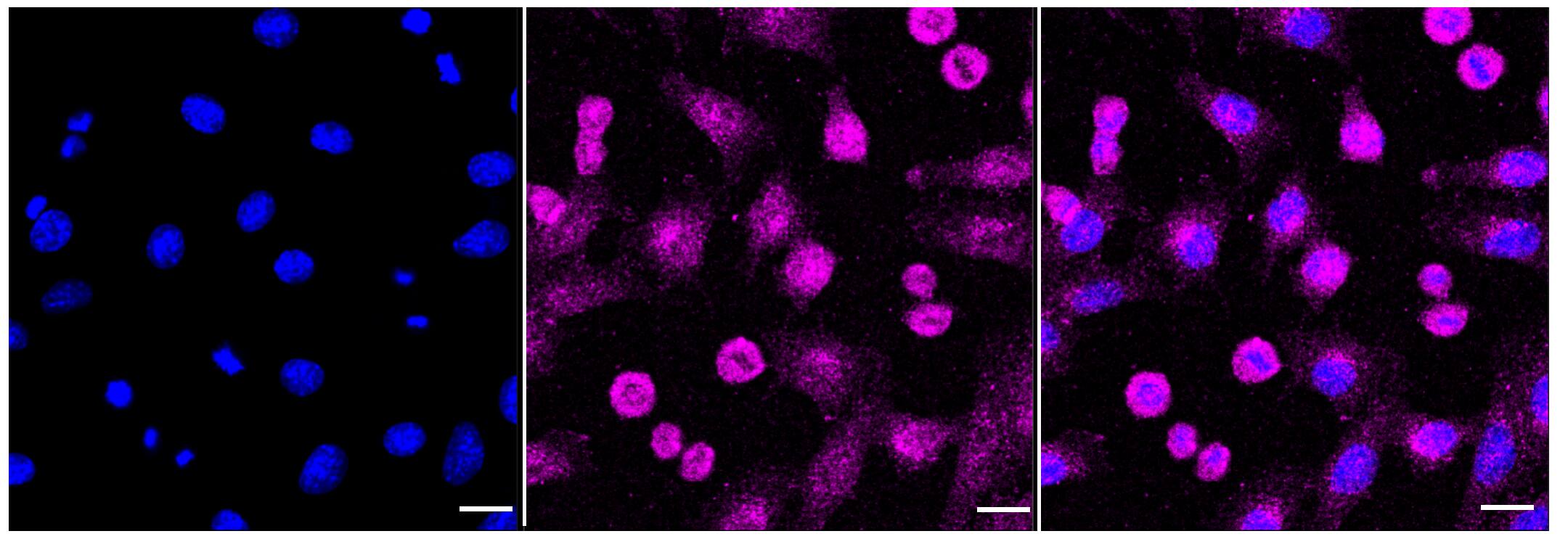 Immunocytochemical staining of C2C12 cells with DNAJC15 antibody (1:1,000). Nuclei were stained blue with DAPI; DNAJC15 was stained magenta with Alexa Fluor(R) 647. Images were taken using Leica stellaris 5. Protein abundance based on laser Intensity and smart gain: Low. Scale bar, 20 um.