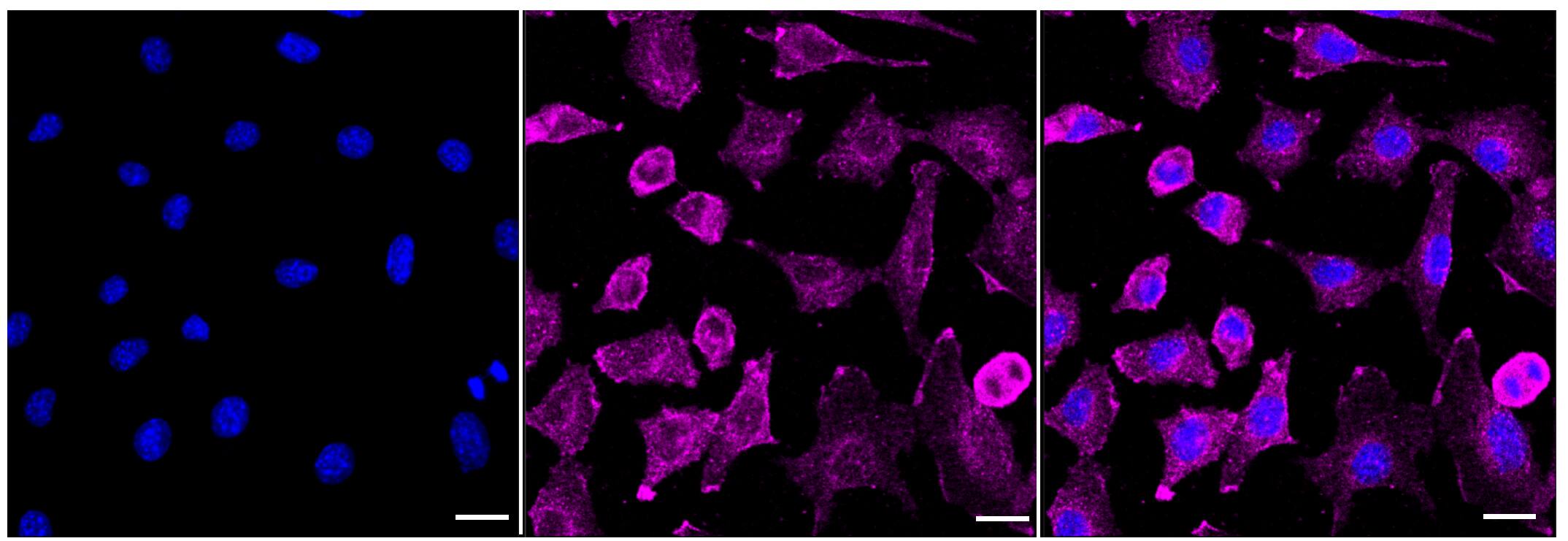Immunocytochemical staining of C2C12 cells with Elp3 antibody (1:1,000). Nuclei were stained blue with DAPI; Elp3 was stained magenta with Alexa Fluor(R) 647. Images were taken using Leica stellaris 5. Protein abundance based on laser Intensity and smart gain: Medium. Scale bar, 20 um.