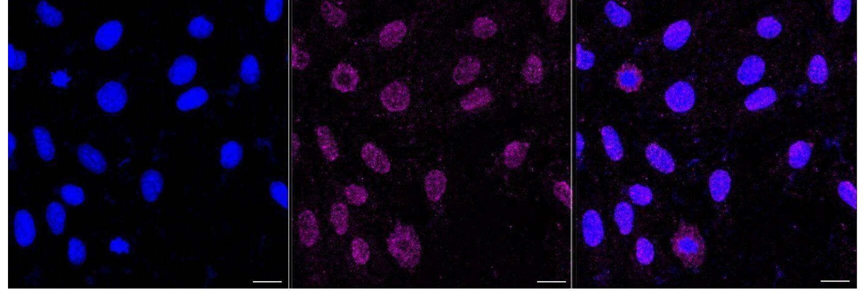 Immunocytochemical staining of H9c2 cells with CD39L4/ENTPD5 antibody (1:1,000) . Nuclei were stained blue with DAPI; CD39L4/ENTPD5 was stained magenta with Alexa Fluor(R) 647. Images were taken using Leica stellaris 5. Protein abundance based on laser Intensity and smart gain: Low. Scale bar, 20 um.