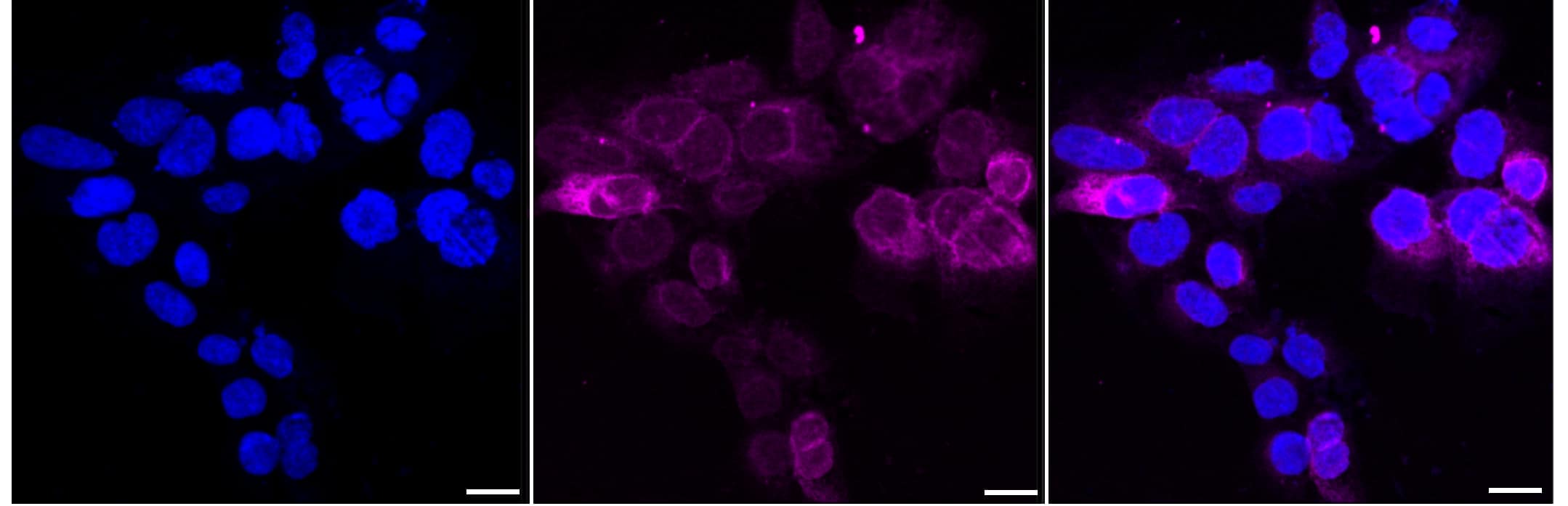 Immunocytochemical staining of HAP-1 cells with FDFT1 antibody (1:1,000). Nuclei were stained blue with DAPI; FDFT1 was stained magenta with Alexa Fluor(R) 647. Images were taken using Leica stellaris 5. Protein abundance based on laser Intensity and smart gain: Medium. Scale bar, 20 um.
