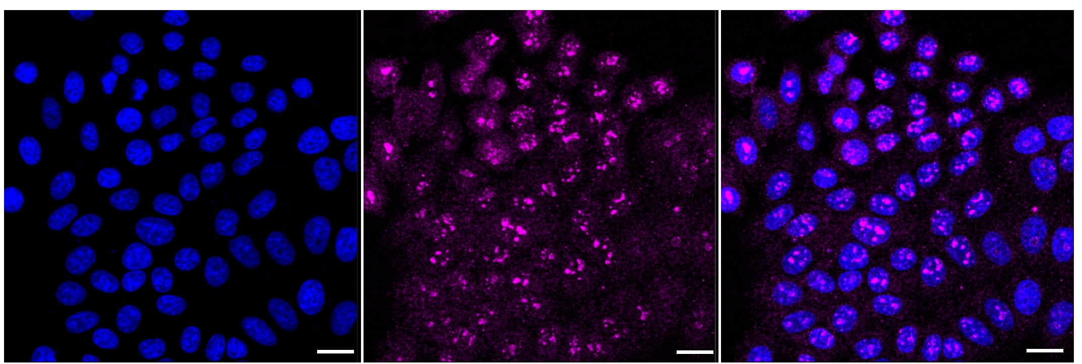 Immunocytochemical staining of HepG2 cells with Filamin A antibody (1:1,000). Nuclei were stained blue with DAPI; Filamin A was stained magenta with Alexa Fluor(R) 647. Images were taken using Leica stellaris 5. Protein abundance based on laser Intensity and smart gain: Medium. Scale bar, 20 um.