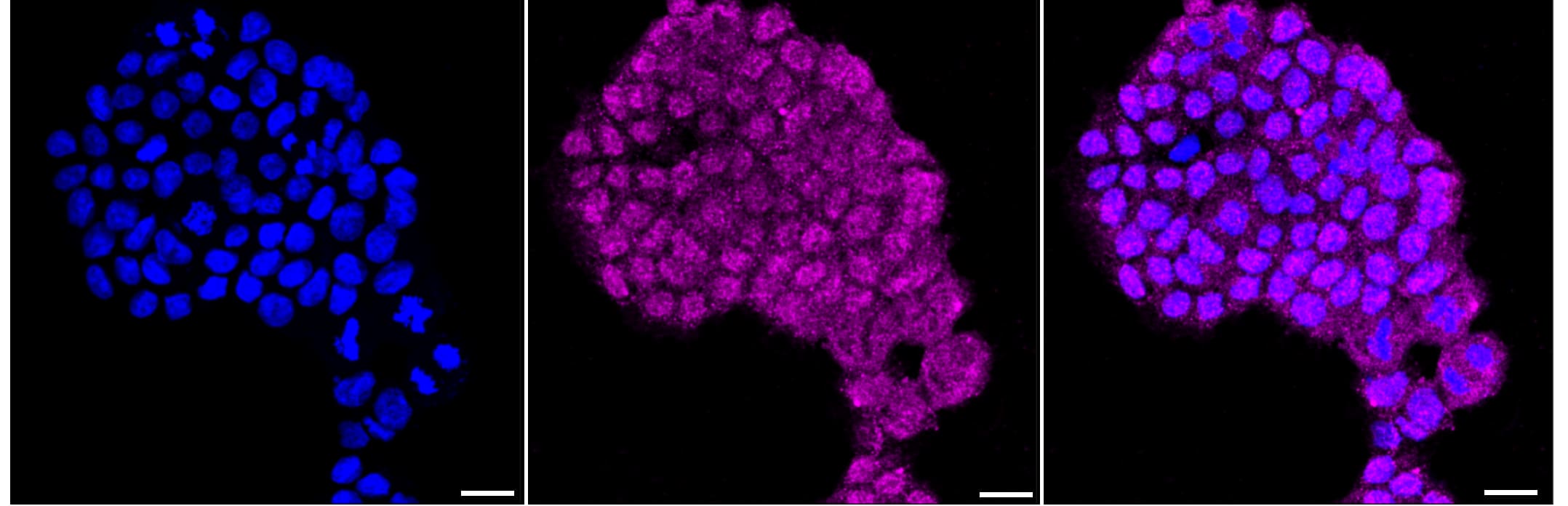 Immunocytochemical staining of HAP-1 cells with FNTB antibody (1:1,000) . Nuclei were stained blue with DAPI; FNTB was stained magenta with Alexa Fluor(R) 647. Images were taken using Leica stellaris 5. Protein abundance based on laser Intensity and smart gain:Medium. Scale bar, 20 um.