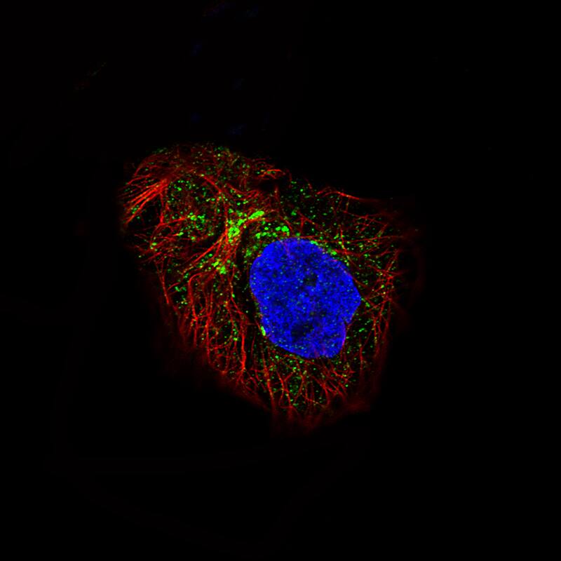 Staining of A-431 cells showing specific staining in vesicles and the golgi apparatus in green. Microtubule- and nuclear probes are visualized in red and blue, respectively (where available).