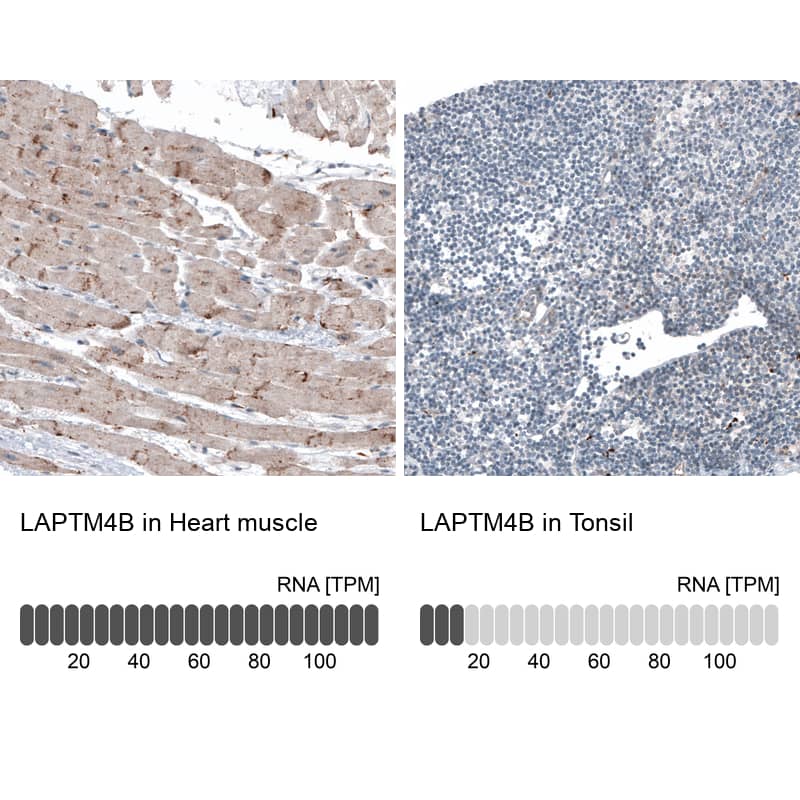 Analysis in human heart muscle and tonsil tissues. Corresponding LAPTM4B RNA-seq data are presented for the same tissues.