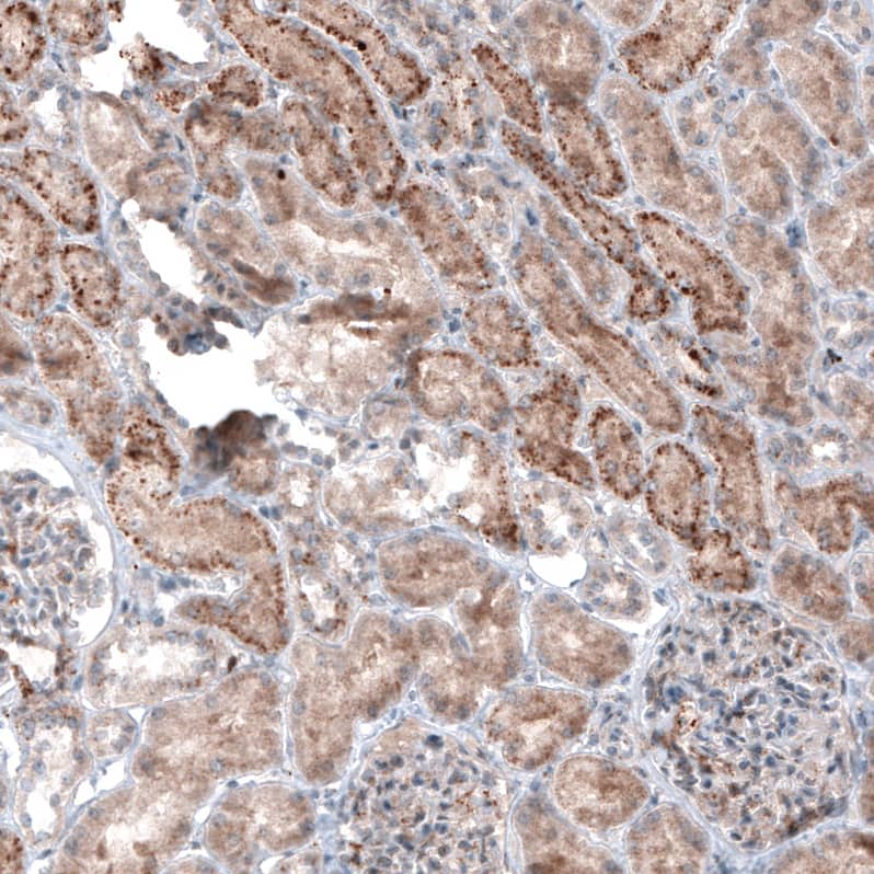 Immunohistochemistry LAPTM4B Antibody (CL5289)