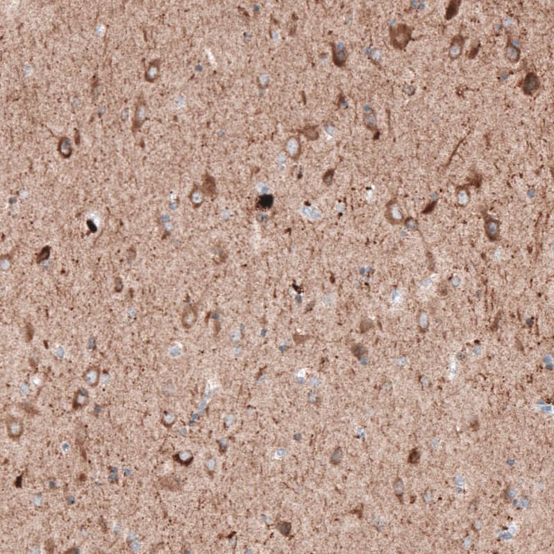 Immunohistochemistry LAPTM4B Antibody (CL5289)