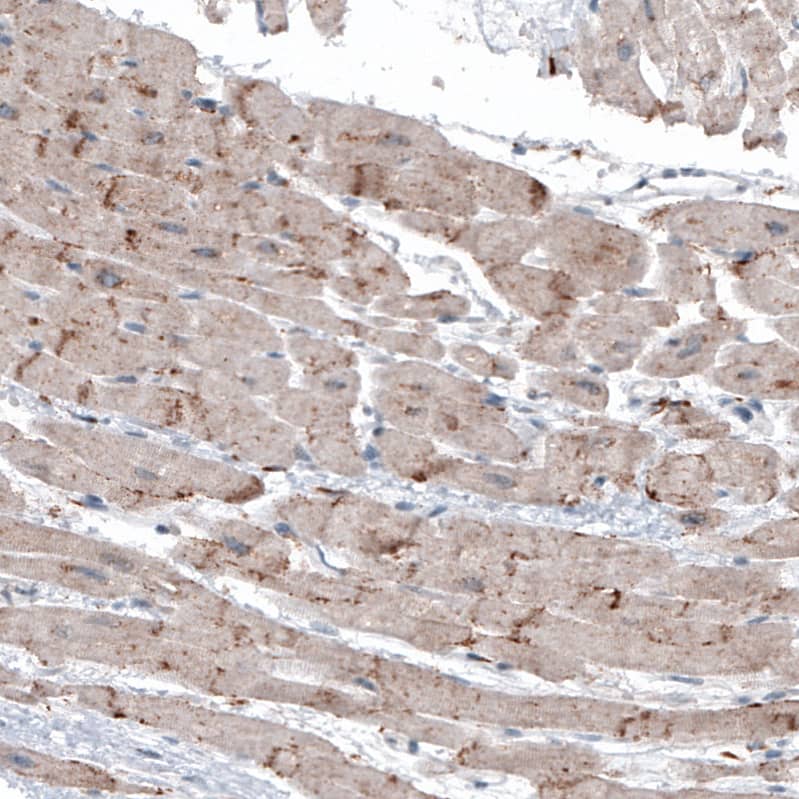 Immunohistochemistry LAPTM4B Antibody (CL5289)
