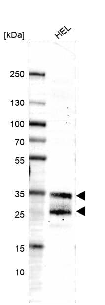 Analysis in human cell line HEL.