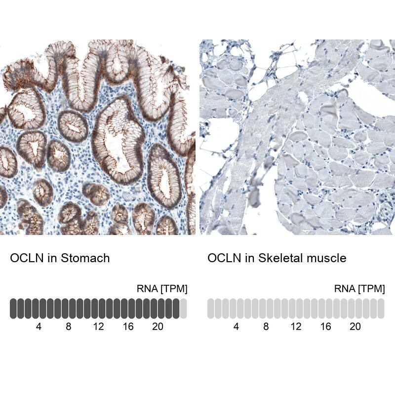 Analysis in human stomach and skeletal muscle tissues. Corresponding Occludin RNA-seq data are presented for the same tissues.