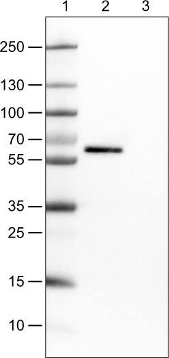 Lane 1: Marker [kDa]Lane 2: Human cell line CACO-2Lane 3: Human cell line U-87