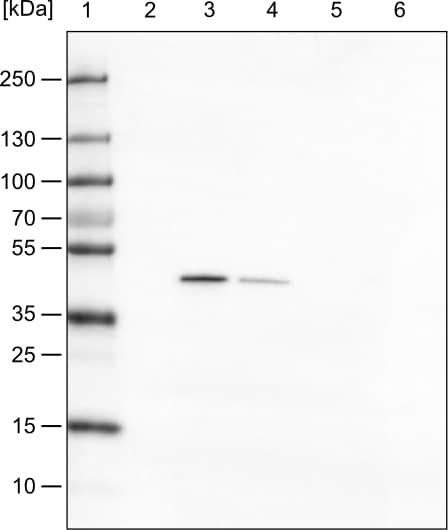 Lane 1: Marker [kDa]Lane 2: Human cell line HeLa cytoplasmic fractionLane 3: Human cell line HeLa membrane fractionLane 4: Human cell line HeLa nuclear fractionLane 5: Human cell line HeLa chromatin fractionLane 6: Human cell line HeLa cytoskeletal fraction