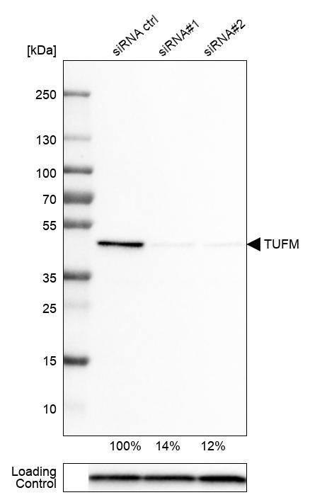 Analysis in U-251MG cells transfected with control siRNA, target specific siRNA probe #1 and #2,. Remaining relative intensity is presented. Loading control: Anti-PPIB.