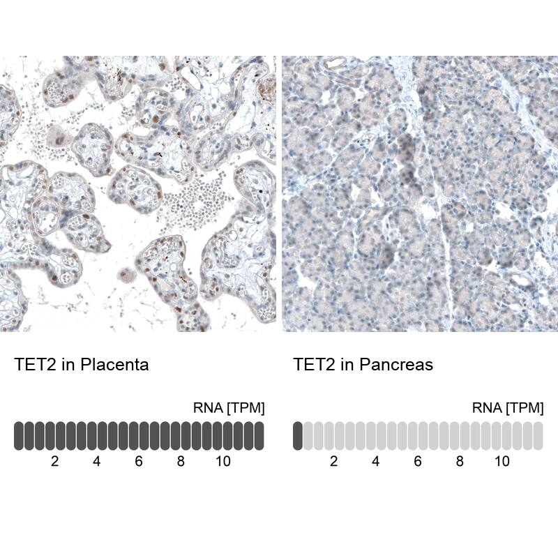 Immunohistochemistry TET2 Antibody (CL6873)