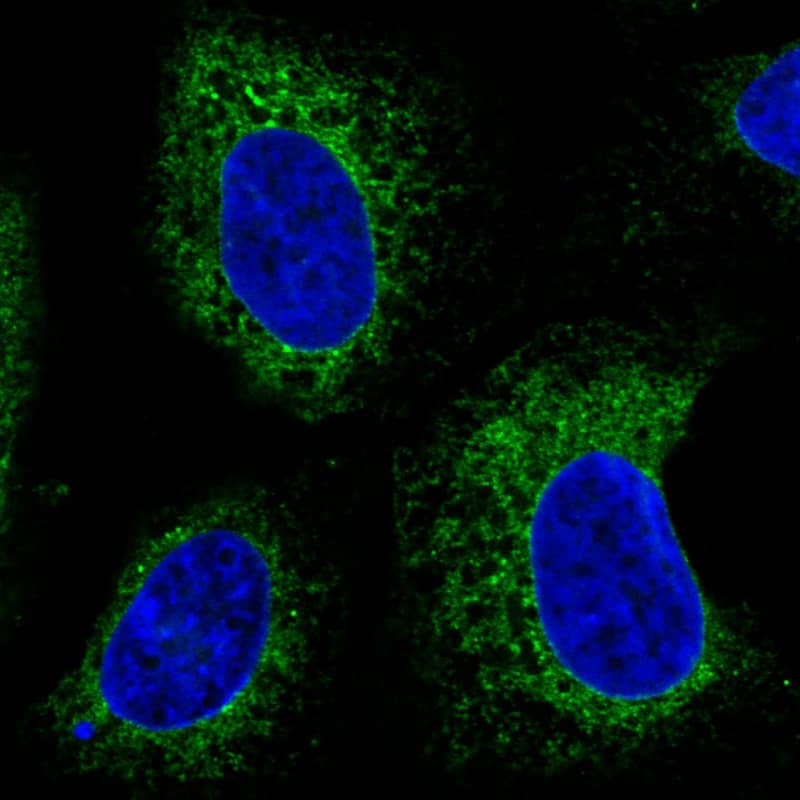 Staining in U2OS cell line  showing specific staining of endoplasmic reticulum in green. Microtubule- and nuclear probes are visualized in red and blue respectively (where available).